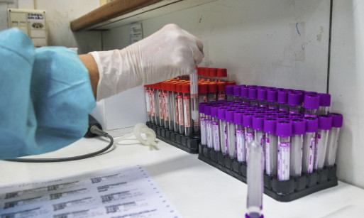 Covid-19: UFRJ desenvolve teste 20 vezes mais barato