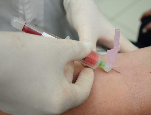 Jundiaí adquire 10 mil kits de teste rápido
